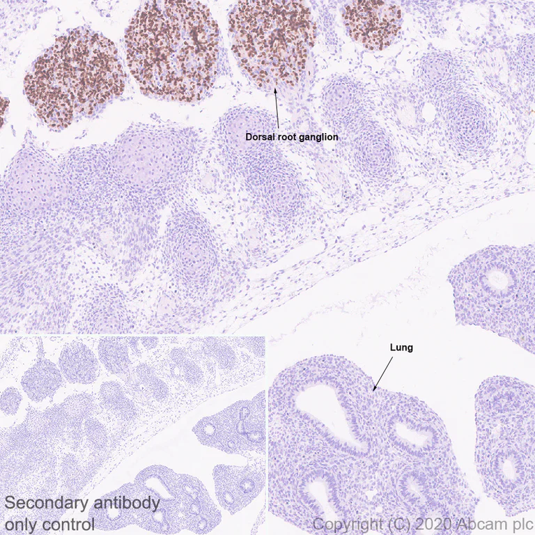 Immunohistochemistry (Formalin/PFA-fixed paraffin-embedded sections) - Anti-BRN3A antibody [EPR23257-285] - BSA and Azide free (AB273099)