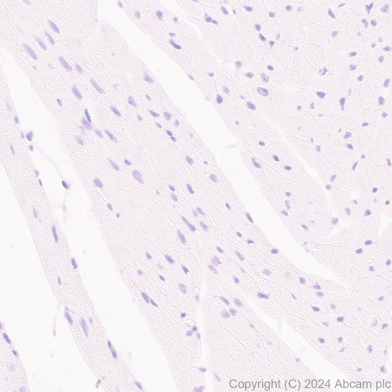 Immunohistochemistry (Formalin/PFA-fixed paraffin-embedded sections) - Anti-BRN3A + BRN3B + BRN3C antibody [EPR26313-54] (AB317492)