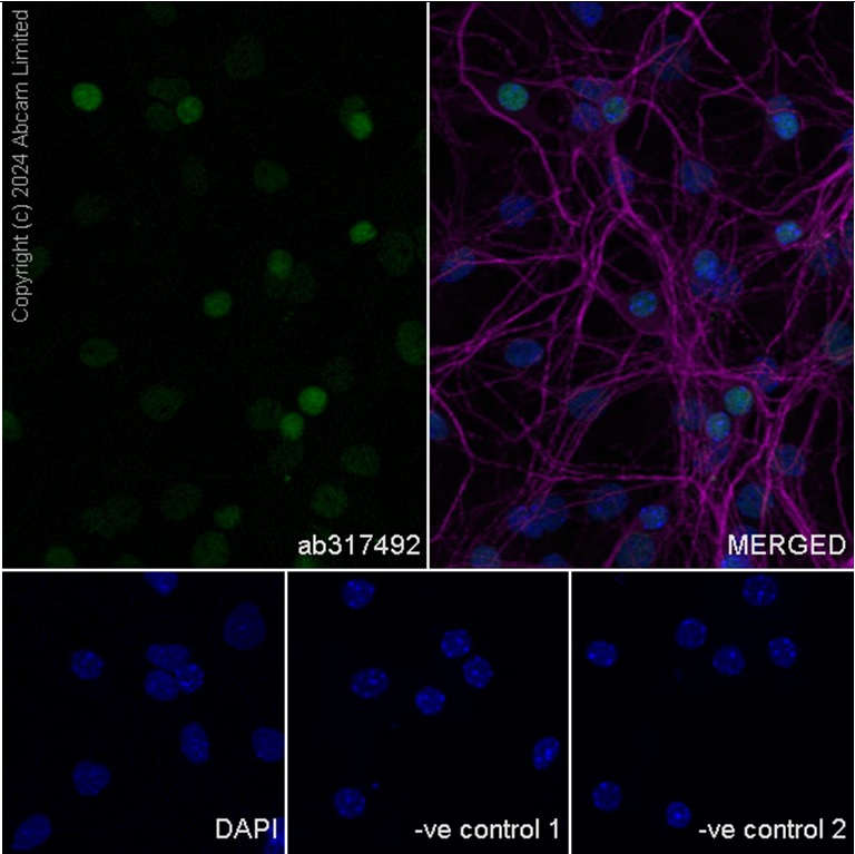 Immunocytochemistry/ Immunofluorescence - Anti-BRN3A + BRN3B + BRN3C antibody [EPR26313-54] - BSA and Azide free (ab317493), expandable thumbnail