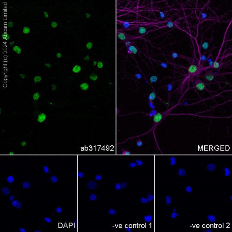 Immunocytochemistry/ Immunofluorescence - Anti-BRN3A + BRN3B + BRN3C antibody [EPR26313-54] - BSA and Azide free (AB317493), expandable thumbnail