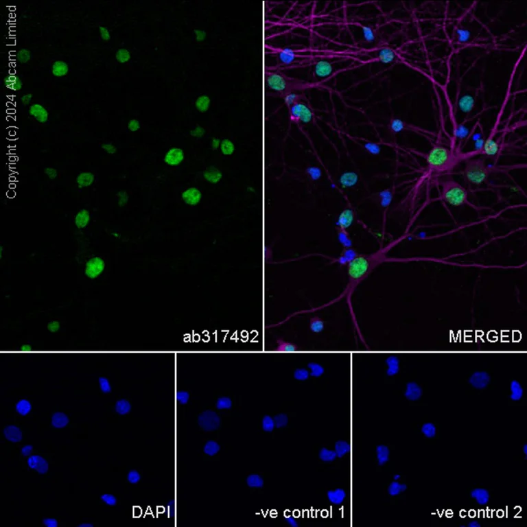 Immunocytochemistry/ Immunofluorescence - Anti-BRN3A + BRN3B + BRN3C antibody [EPR26313-54] - BSA and Azide free (AB317493)