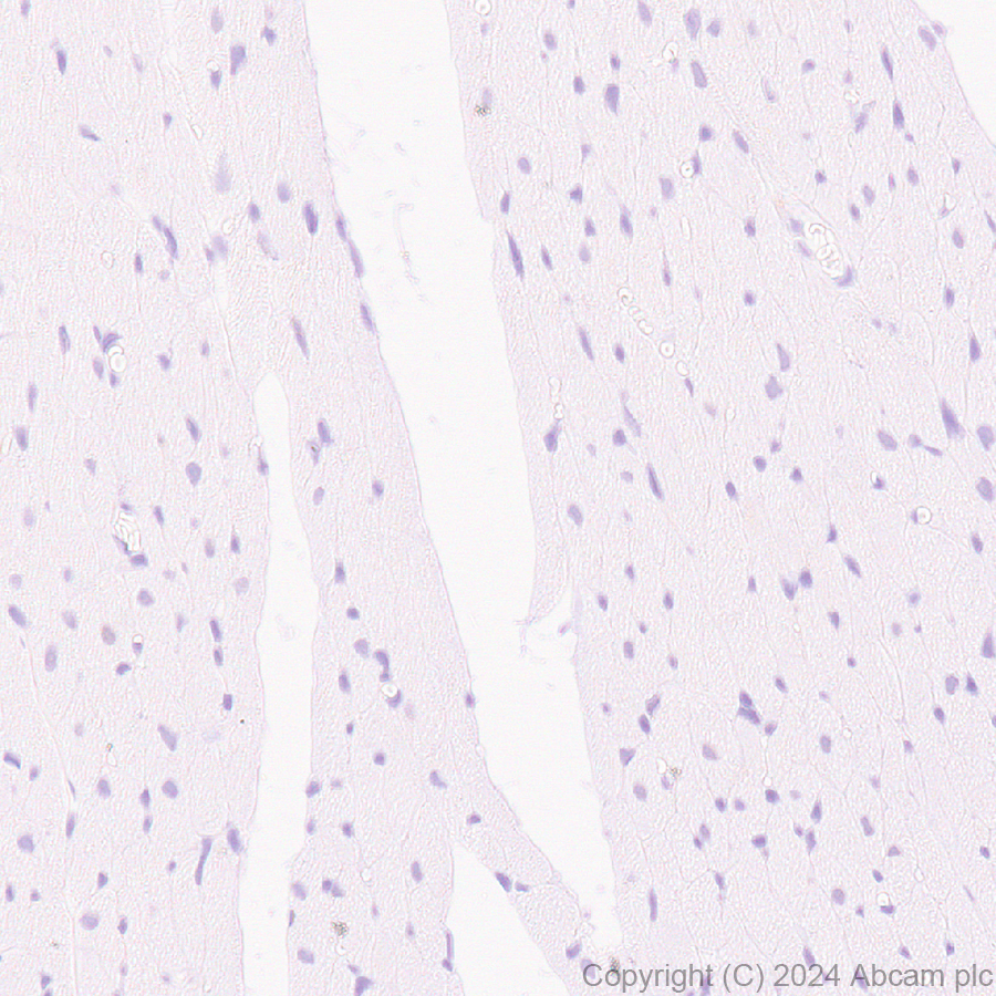 Immunohistochemistry (Formalin/PFA-fixed paraffin-embedded sections) - Anti-BRN3A + BRN3B + BRN3C antibody [EPR26313-54] - BSA and Azide free (ab317493), expandable thumbnail