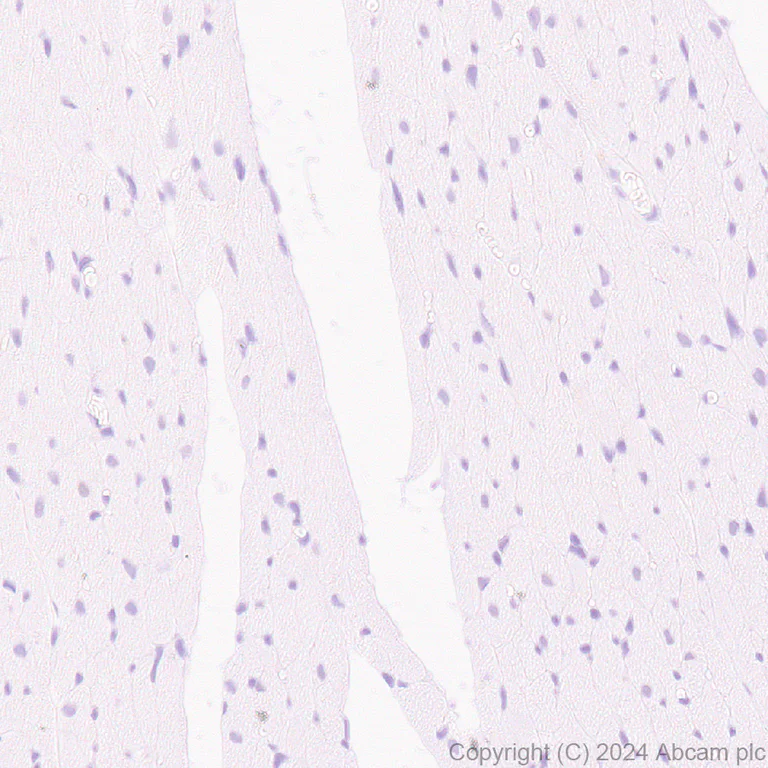 Immunohistochemistry (Formalin/PFA-fixed paraffin-embedded sections) - Anti-BRN3A + BRN3B + BRN3C antibody [EPR26313-54] - BSA and Azide free (AB317493)