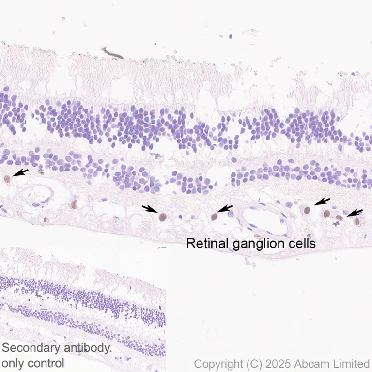 Immunohistochemistry (Formalin/PFA-fixed paraffin-embedded sections) - Anti-BRN3B / POU4F2 antibody [EPR28922-88] (AB325130)