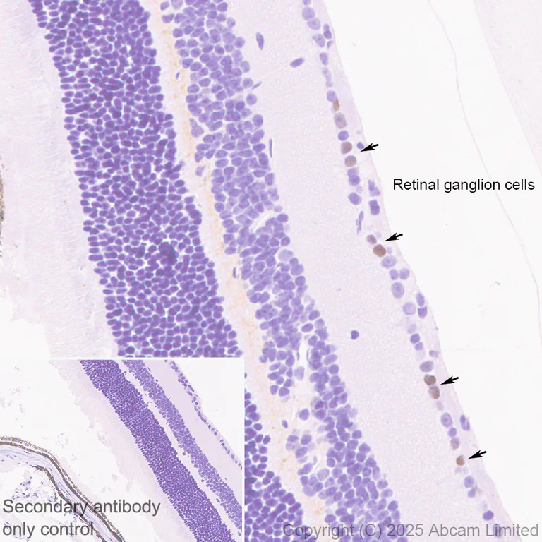Immunohistochemistry (Formalin/PFA-fixed paraffin-embedded sections) - Anti-BRN3B / POU4F2 antibody [EPR28922-88] (AB325130)