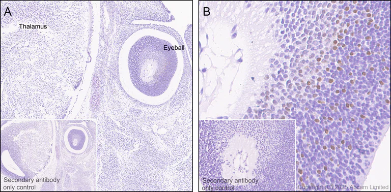 Immunohistochemistry (Formalin/PFA-fixed paraffin-embedded sections) - Anti-BRN3B / POU4F2 antibody [EPR28922-88] (AB325130)
