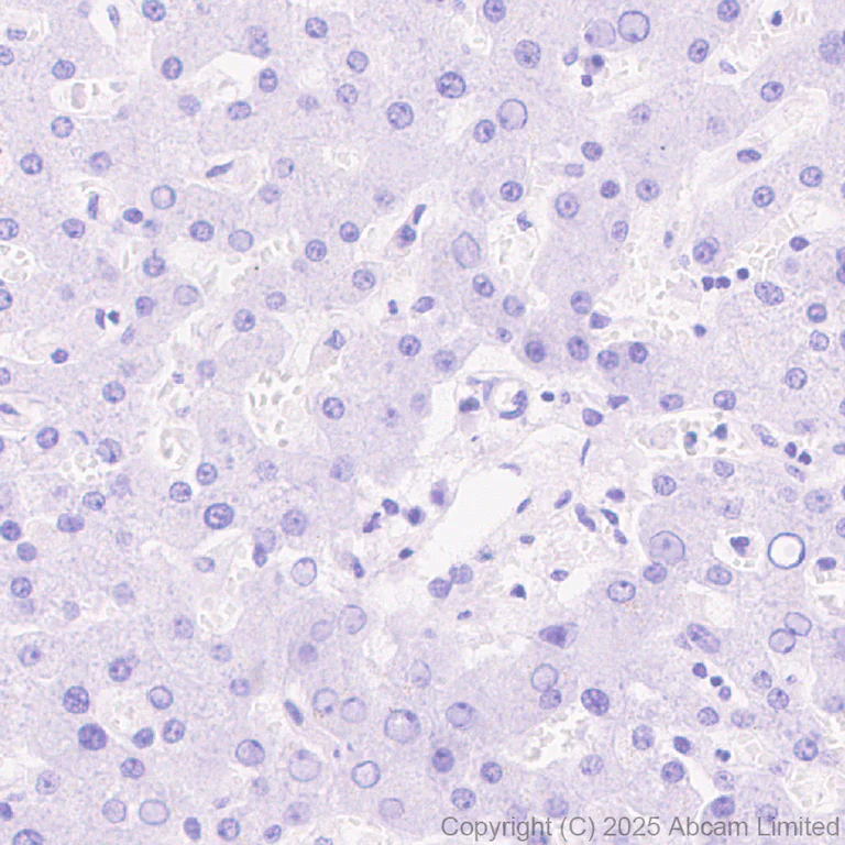 Immunohistochemistry (Formalin/PFA-fixed paraffin-embedded sections) - Anti-BRN3B / POU4F2 antibody [EPR28922-88] (AB325130)