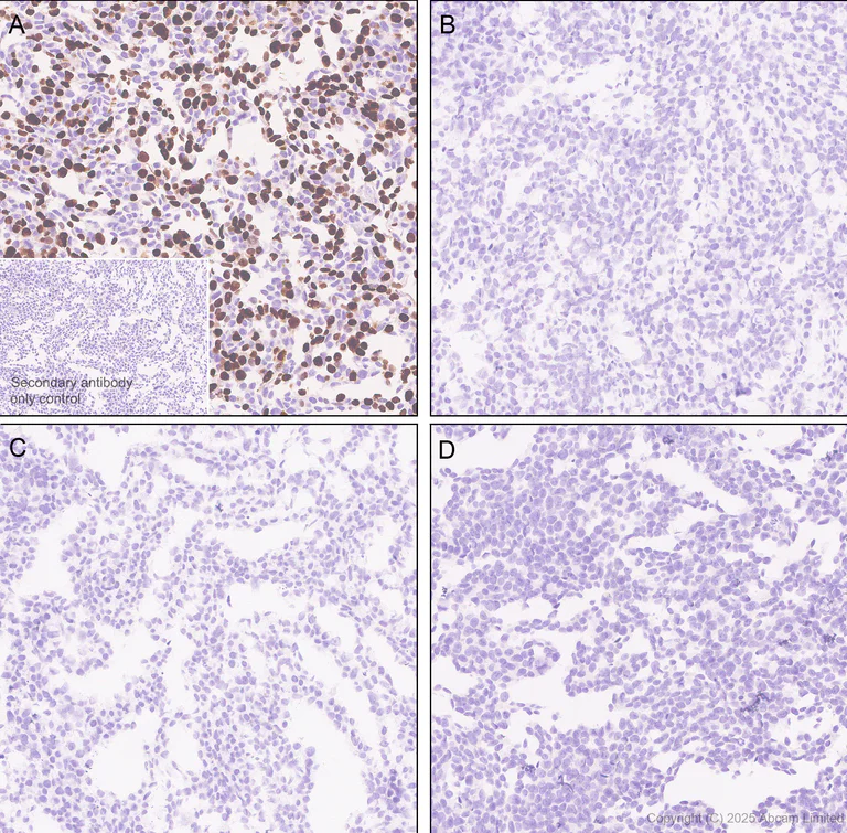 Immunohistochemistry (Formalin/PFA-fixed paraffin-embedded sections) - Anti-BRN3B / POU4F2 antibody [EPR28922-88] - BSA and Azide free (AB325741)