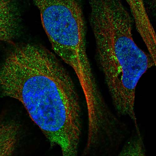 Immunocytochemistry/ Immunofluorescence - Anti-BROX antibody (AB122174), expandable thumbnail