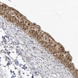 Immunohistochemistry (Formalin/PFA-fixed paraffin-embedded sections) - Anti-BROX antibody (AB122174)