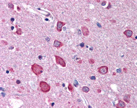 Immunohistochemistry (Formalin/PFA-fixed paraffin-embedded sections) - Anti-BRSK1 antibody (AB115475)