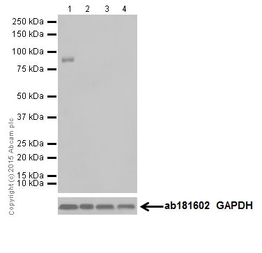 Western blot - Anti-BRSK1 antibody [EPR18190] (AB206298)