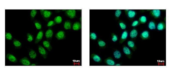 Immunocytochemistry/ Immunofluorescence - Anti-BS69 antibody (AB227086), expandable thumbnail