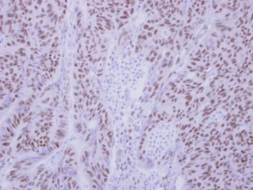 Immunohistochemistry (Formalin/PFA-fixed paraffin-embedded sections) - Anti-BS69 antibody (AB227086), expandable thumbnail