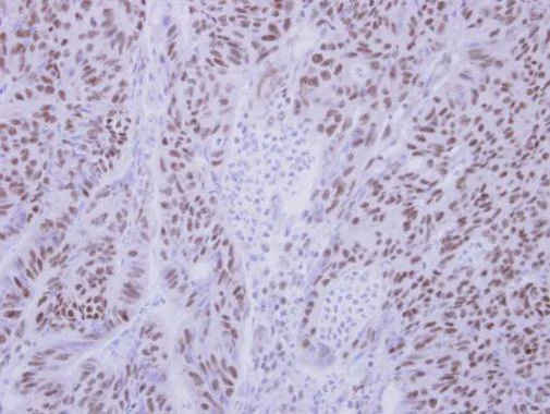 Immunohistochemistry (Formalin/PFA-fixed paraffin-embedded sections) - Anti-BS69 antibody (AB227086)