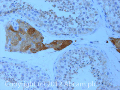 Immunohistochemistry (Formalin/PFA-fixed paraffin-embedded sections) - Anti-BSCL2/Seipin antibody (AB106793)