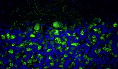 Immunohistochemistry (Formalin/PFA-fixed paraffin-embedded sections) - Anti-Bsn antibody [L124/59] - Chicken IgY (Chimeric) (AB325674)