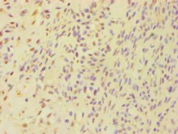 Immunohistochemistry (Formalin/PFA-fixed paraffin-embedded sections) - Anti-BSND antibody (AB238741)