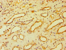 Immunohistochemistry (Formalin/PFA-fixed paraffin-embedded sections) - Anti-BSND antibody (AB238741)
