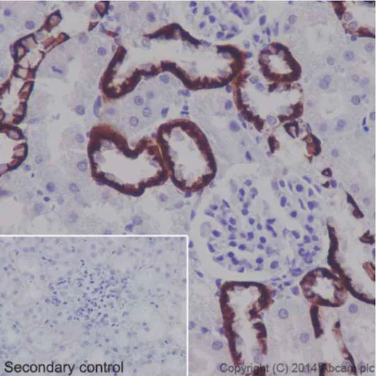 Immunohistochemistry (Formalin/PFA-fixed paraffin-embedded sections) - Anti-BSND antibody [EPR14270] - C-terminal (AB196017)