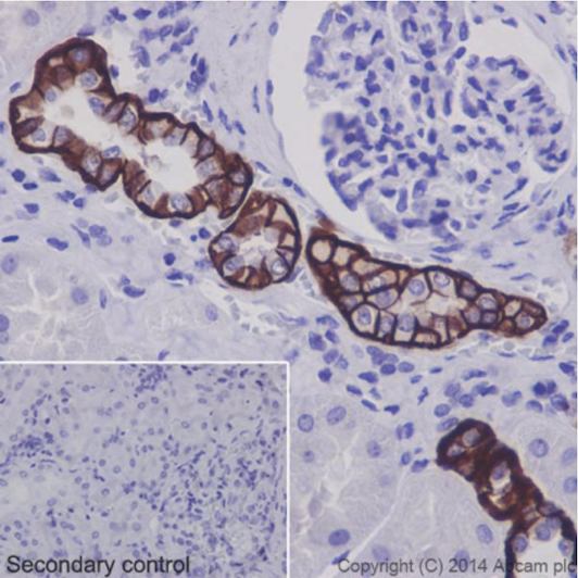 Immunohistochemistry (Formalin/PFA-fixed paraffin-embedded sections) - Anti-BSND antibody [EPR14270] - C-terminal (AB196017)