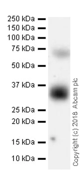 Western blot - Anti-BST2/Tetherin antibody [EPR20202-150] (AB243230)