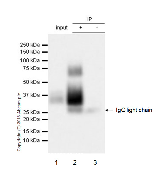 Immunoprecipitation - Anti-BST2/Tetherin antibody [EPR20202-169] (AB243229), expandable thumbnail