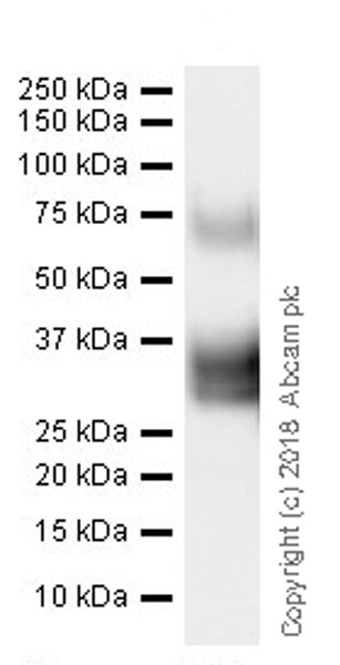 Western blot - Anti-BST2/Tetherin antibody [EPR20202-169] (ab243229), expandable thumbnail