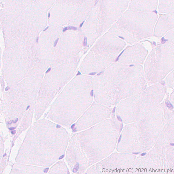 Immunohistochemistry (Formalin/PFA-fixed paraffin-embedded sections) - Anti-BST2/Tetherin antibody [EPR23597-202] (AB246508)