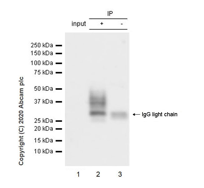 Immunoprecipitation - Anti-BST2/Tetherin antibody [EPR23597-202] (AB246508), expandable thumbnail