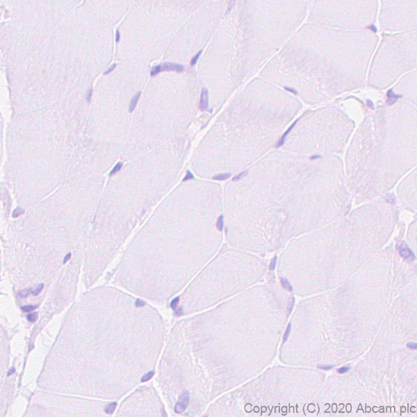 Immunohistochemistry (Formalin/PFA-fixed paraffin-embedded sections) - Anti-BST2/Tetherin antibody [EPR23597-202] - BSA and Azide free (AB272175)