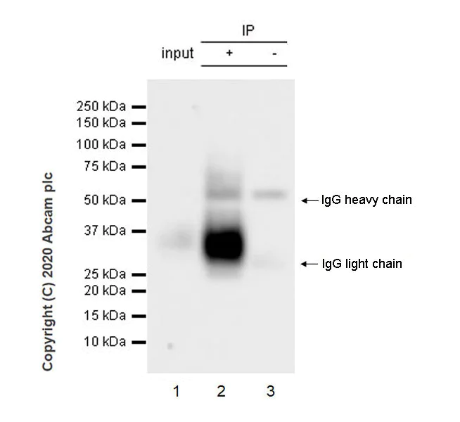 Immunoprecipitation - Anti-BST2/Tetherin antibody [EPR23597-266] - BSA and Azide free (AB272176)