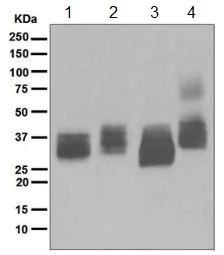 Western blot - Anti-BST2/Tetherin antibody [EPR5648] (AB134061)