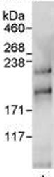 Immunoprecipitation - Anti-BTAF1 antibody (AB72285)
