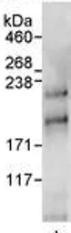 Immunoprecipitation - Anti-BTAF1 antibody (AB72285)