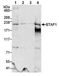 Western blot - Anti-BTAF1 antibody (AB72285)