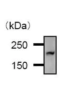 Immunoprecipitation - Anti-BTAF1 antibody [BTA3D61] (AB50990)