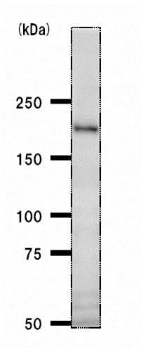 Western blot - Anti-BTAF1 antibody [BTA3D61] (AB50990)