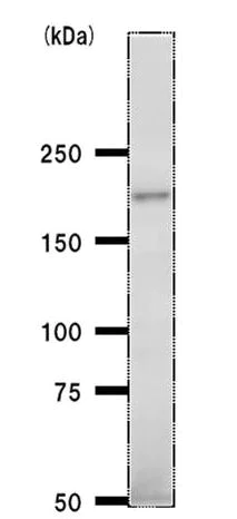 Western blot - Anti-BTAF1 antibody [BTA3D61] (AB50990)
