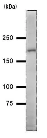 Western blot - Anti-BTAF1 antibody [BTA3D61] (AB50990)