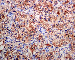 Immunohistochemistry (Formalin/PFA-fixed paraffin-embedded sections) - Anti-BTBD17 antibody [EPR9593(B)] - BSA and Azide free (AB248854), expandable thumbnail