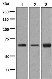 Western blot - Anti-BTBD17 antibody [EPR9593(B)] - BSA and Azide free (AB248854)