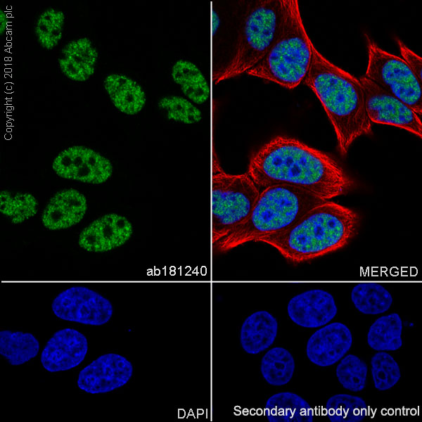 Immunocytochemistry/ Immunofluorescence - Anti-BTF antibody [EPR9980(2)] (AB181240), expandable thumbnail