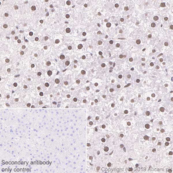 Immunohistochemistry (Formalin/PFA-fixed paraffin-embedded sections) - Anti-BTF antibody [EPR9980(2)] (AB181240), expandable thumbnail