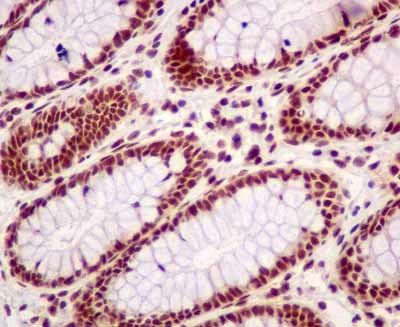 Immunohistochemistry (Formalin/PFA-fixed paraffin-embedded sections) - Anti-BTF antibody [EPR9980(2)] (ab181240), expandable thumbnail