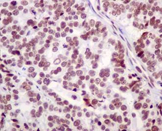 Immunohistochemistry (Formalin/PFA-fixed paraffin-embedded sections) - Anti-BTF antibody [EPR9980(2)] (ab181240), expandable thumbnail