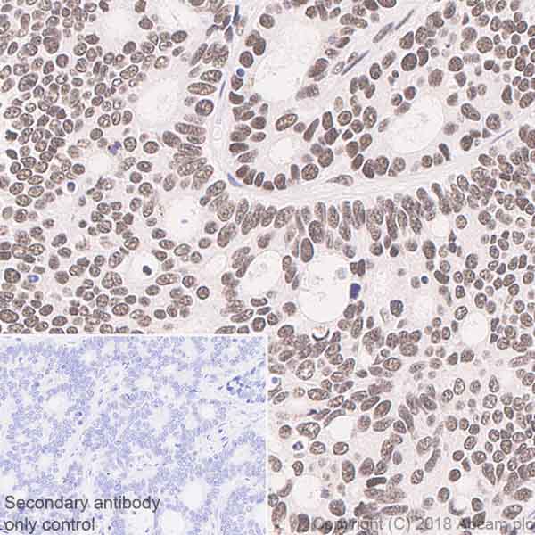 Immunohistochemistry (Formalin/PFA-fixed paraffin-embedded sections) - Anti-BTF antibody [EPR9980(2)] (AB181240), expandable thumbnail