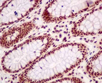 Immunohistochemistry (Formalin/PFA-fixed paraffin-embedded sections) - Anti-BTF antibody [EPR9980(2)] - BSA and Azide free (AB236159)