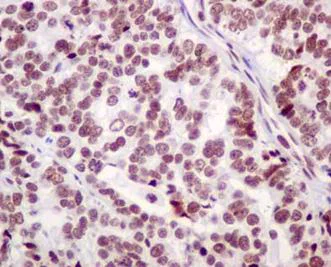 Immunohistochemistry (Formalin/PFA-fixed paraffin-embedded sections) - Anti-BTF antibody [EPR9980(2)] - BSA and Azide free (AB236159)
