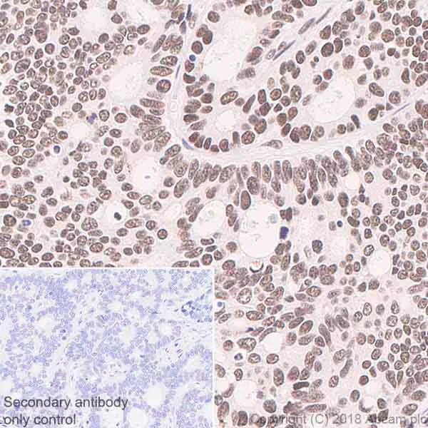 Immunohistochemistry (Formalin/PFA-fixed paraffin-embedded sections) - Anti-BTF antibody [EPR9980(2)] - BSA and Azide free (AB236159)